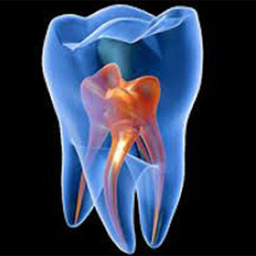 Endodoncia en granada